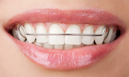 functional-braces