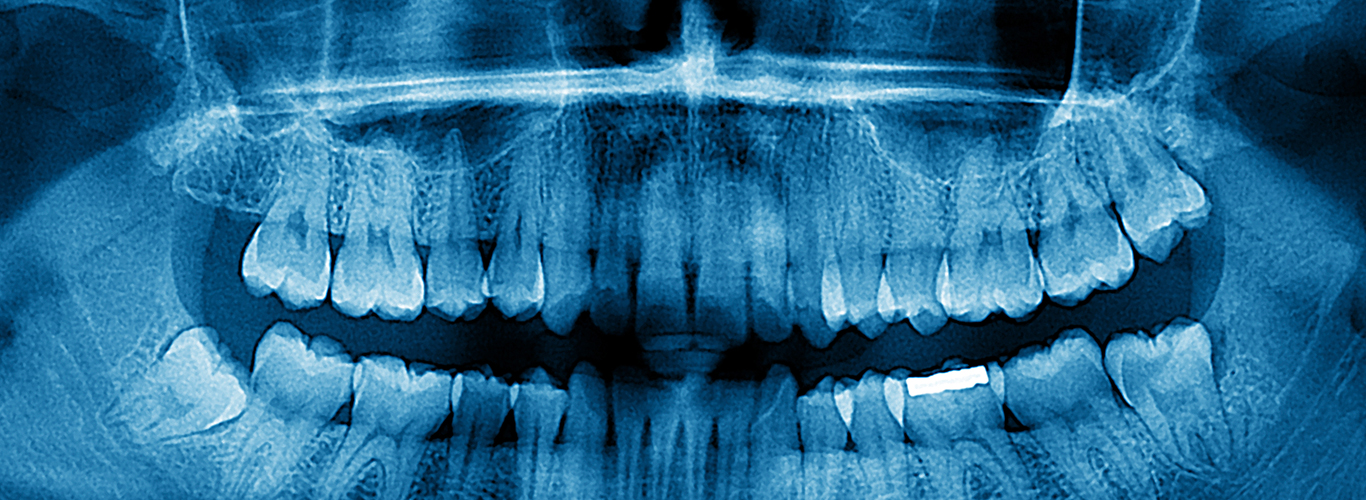 cbct 3d scanner